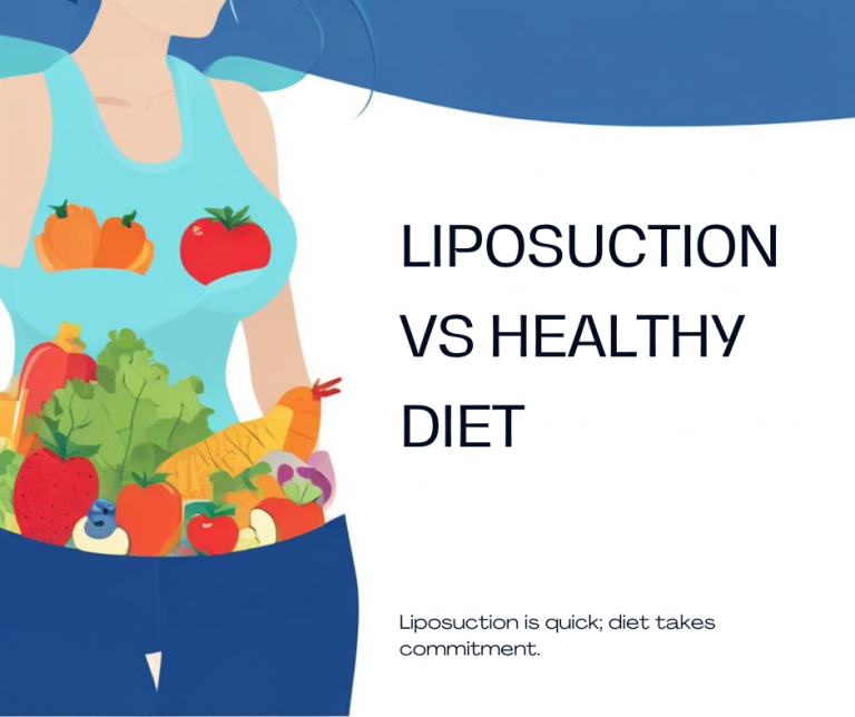 Liposuction vs Healthy Diet