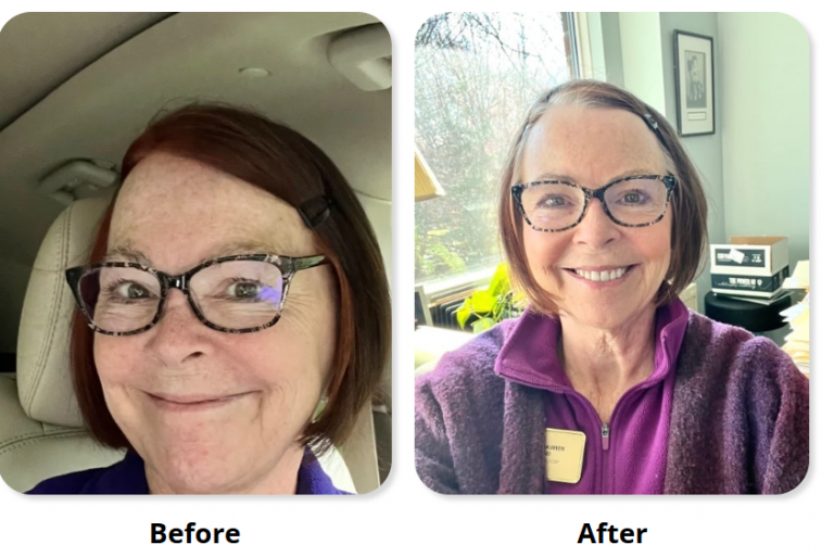 native path collagen dark spot